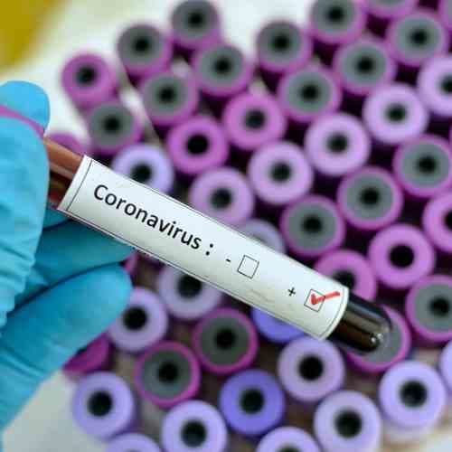 Mobile accessories and electronics devices market feel the heat of Coronavirus