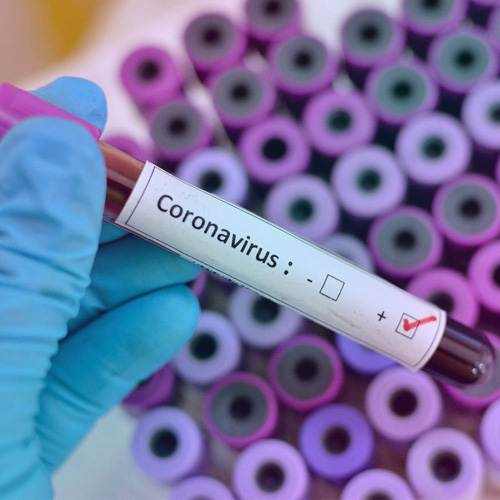India's handling of Coronavirus - 5 Steps urgently required