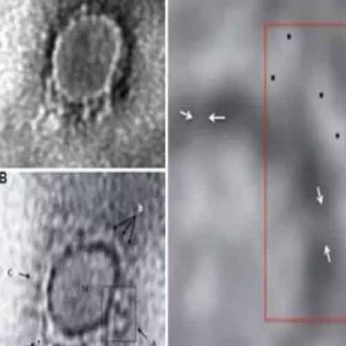 Indian scientists capture image of novel coronavirus causing Covid-19