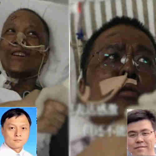 Two Chinese doctors' skin turned dark after infected with COVID-19 Two Chinese doctors' skin turned dark after infected with COVID-19