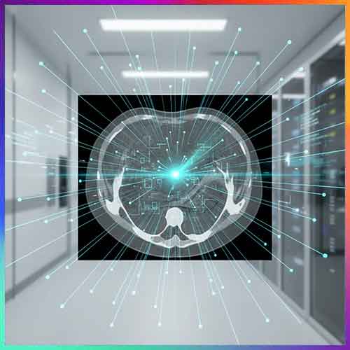 Alibaba’s PANDA AI detects pancreatic cancer early using CT scans