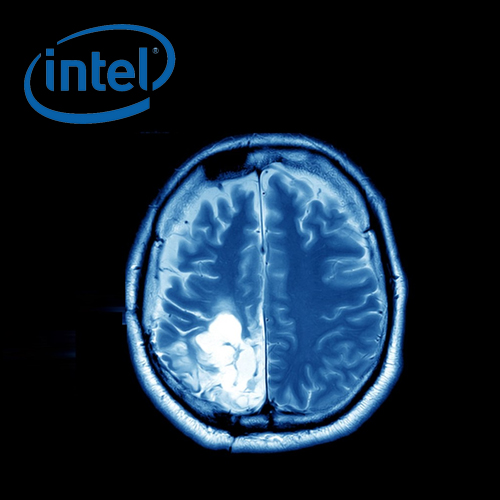 Intel with University of Pennsylvania enables Privacy-Preserving AI to identify brain tumors