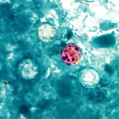 Outbreak Investigation of Cyclospora