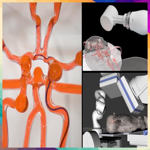 MIT engineers developed joystick-operated robot to treat stroke remotely
