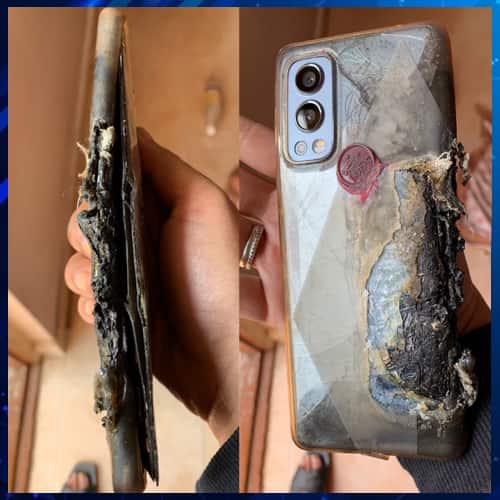 OnePlus Nord 2 smartphone explodes, severely injures user's thigh